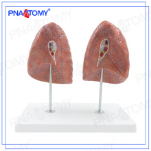 PNT-0475 modelo humano de modelo de pulmón izquierdo y derecho